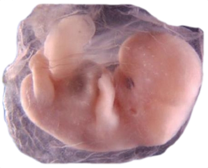 Embryon.jpg